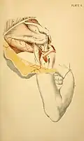 Posterior view of the humerus showing the axillary nerve and posterior circumflex humeral artery at the surgical neck.