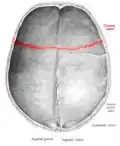 Coronal suture seen from inside.
